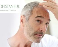Hair Transplant